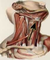"<a href="https://www.flickr.com/photos/133115863@N08/18439175894" target="_blank" rel="noopener noreferrer">88 - Neck muscles, with mandible, hyoid bone, clavicles and laryngeal cartilages2</a>" by <a href="https://www.flickr.com/photos/133115863@N08" target="_blank" rel="noopener noreferrer">Knowledge Collector</a> is licensed under <a href="https://creativecommons.org/publicdomain/mark/1.0/" target="_blank" rel="noopener noreferrer">CC PDM 1.0</a>
