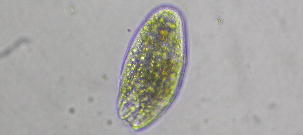 Protozoa Discovered: Microbiology Founded